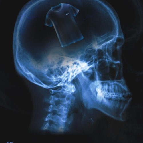 43f4c3206149963.66c752333ddd8